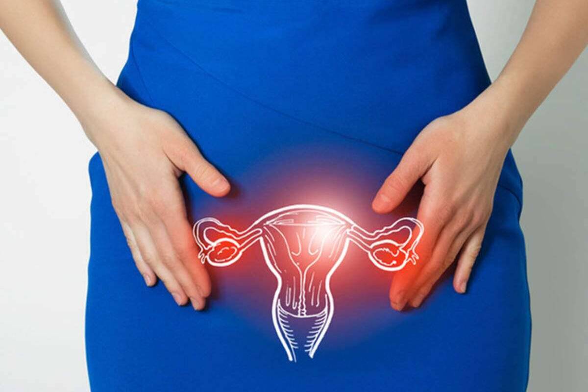 Trompele uterine infundate